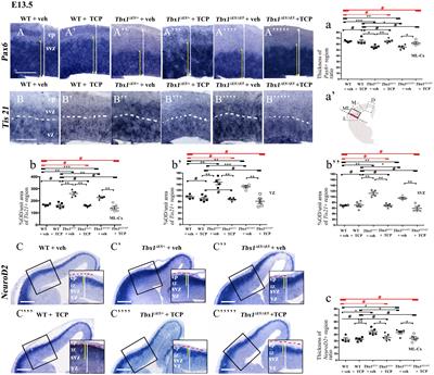 Pharmacological Rescue of the Brain Cortex Phenotype of Tbx1 Mouse Mutants: Significance for 22q11.2 Deletion Syndrome